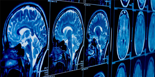Cerebrovascular and Skull Base Surgery